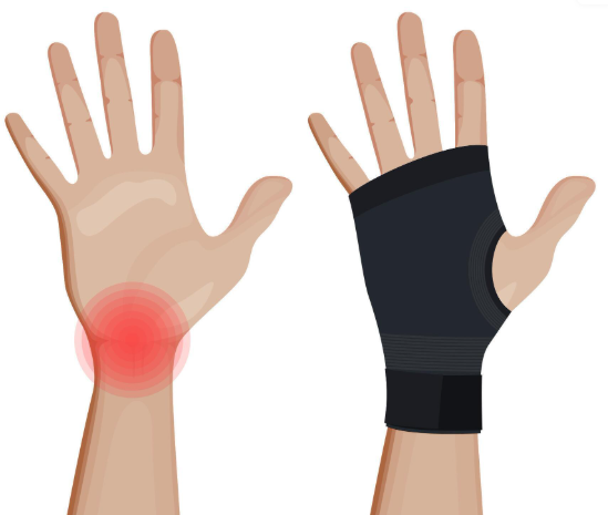 Do Wrist Supports Really Help? Benefits and Myths